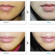 Illustration for article titled Joker Plastic Surgery? Permanent Duck Faces? I'm Not Sure Which!